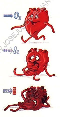 Ilustracin Gouache. Fallo Cardiaco. Revista Nuestra Salud.jpg